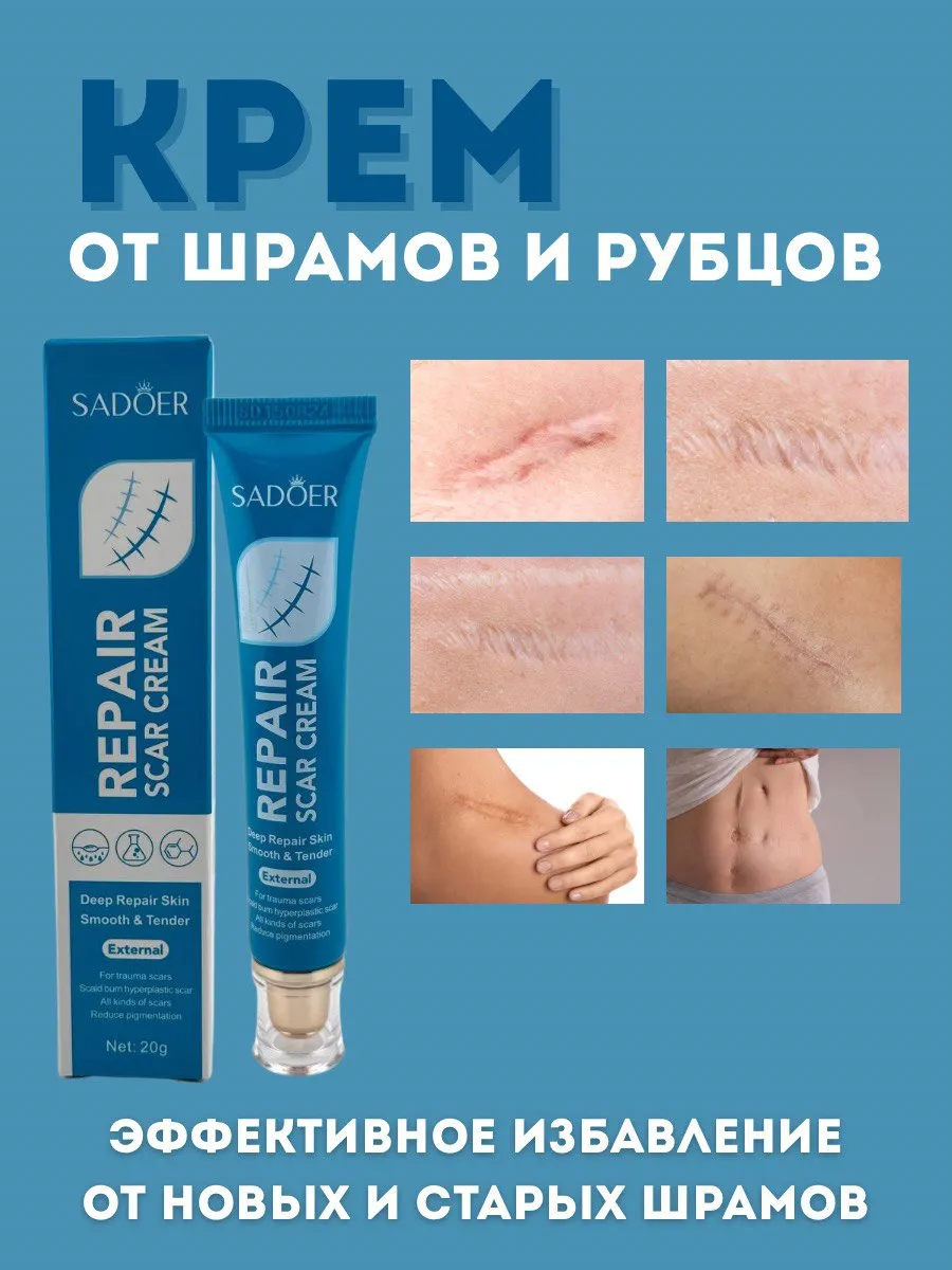 Крем от шрамов и рубцов