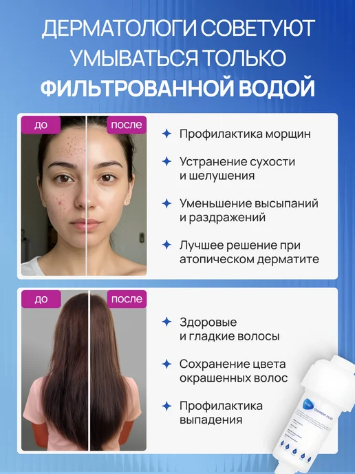 Фильтр для душа и воды от примесей и хлора, белый, фото 2