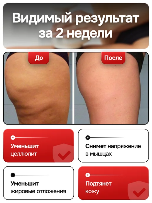Be lite Вакуумный антицеллюлитный массажер для тела ног и ягодиц, белый, фото 3