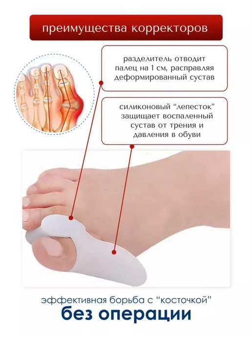 Силиконовые разделители пальцев ног ортопедические, бежевый, фото 2