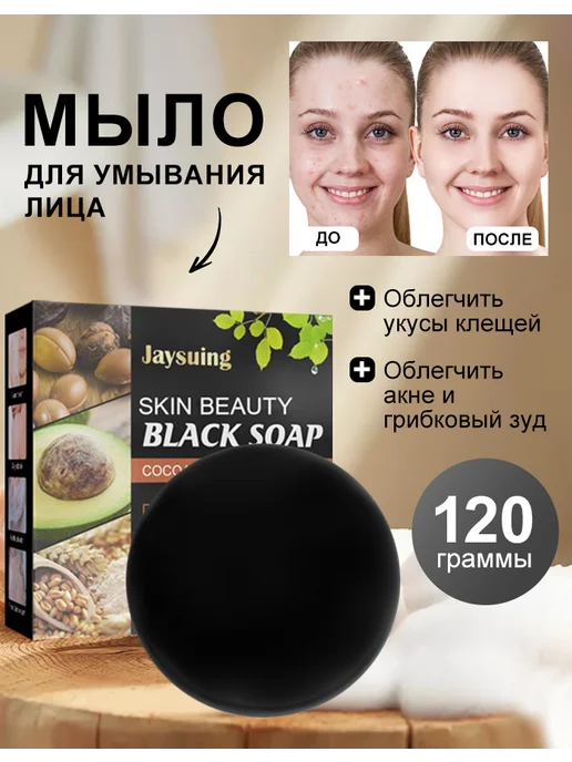 JaySuing мыло от прыщей для лица и тела,3 шт, вариант