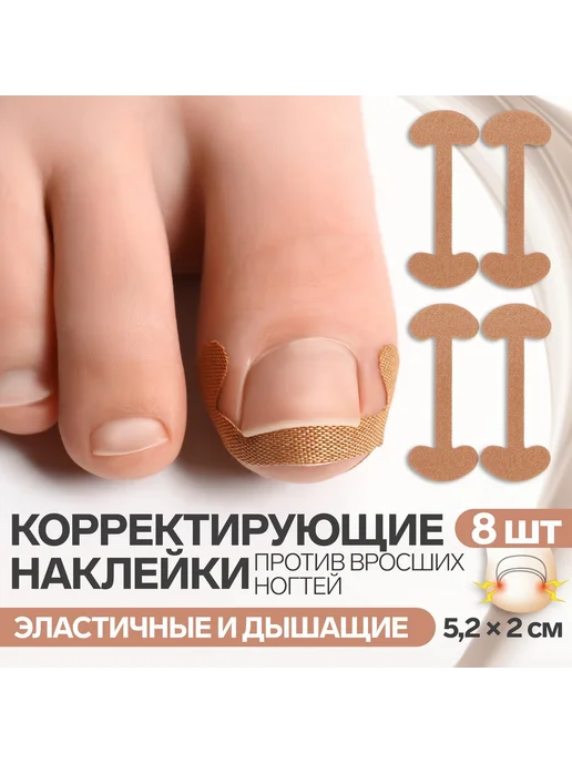 ONLITOP Набор наклеек от вросшего ногтя 8 шт, 8 шт