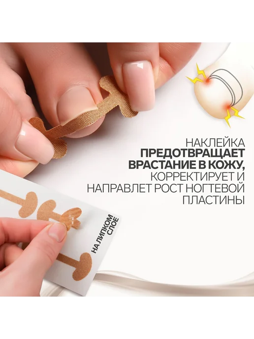 ONLITOP Набор наклеек от вросшего ногтя 8 шт, 8 шт, фото 2