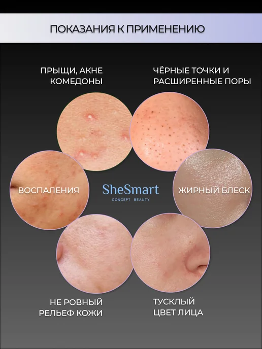 Noproblem Салициловый лосьон тоник для прыщей для жирной кожи, вариант, фото 5