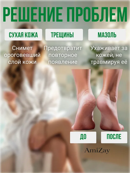 Терка для ног Набор пемза для пяток с крем-воск от трещин, вариант, фото 7