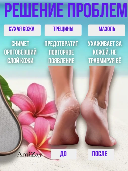 Пемза - Терка для ног Терка для пяток с ручкой наностекло нанотерка, вариант, фото 3