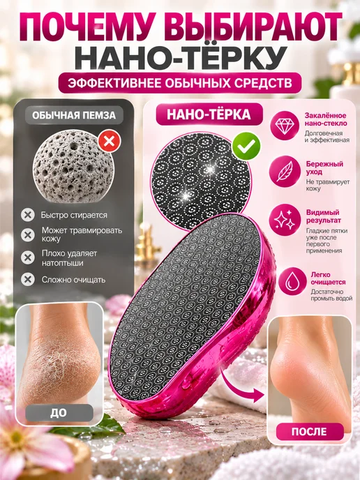 Терка для ног Пемза для пяток нано пилка, синий, фото 3